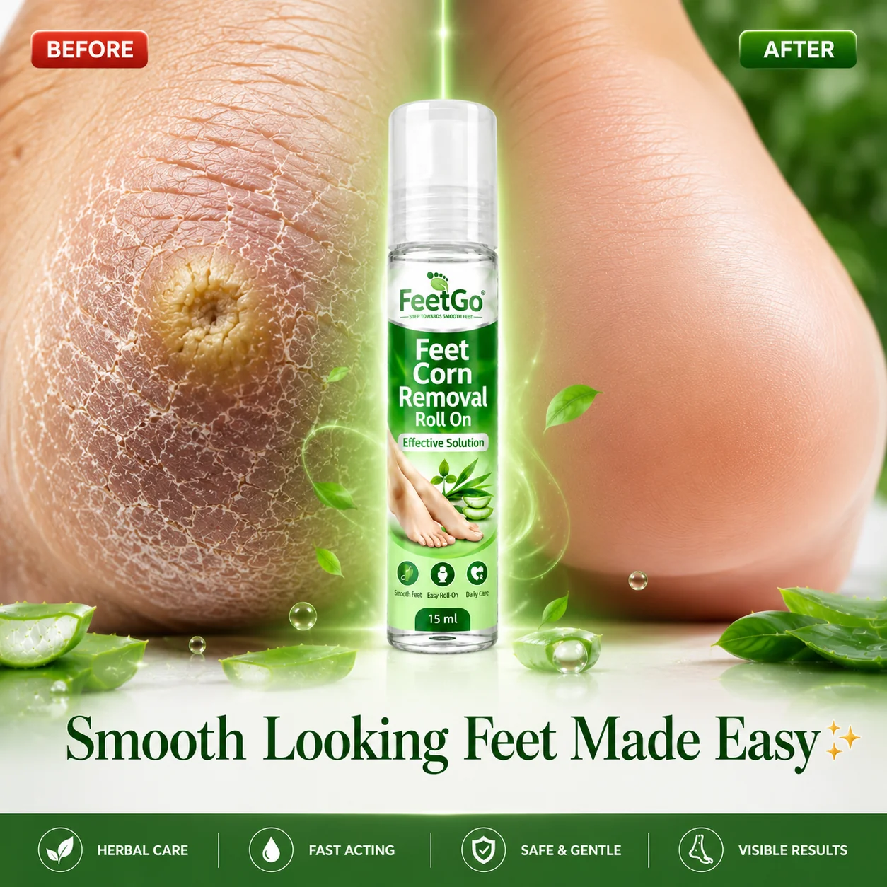 FeetGo Corn Removal Roll-On ( Buy 1 Get 1 Free)