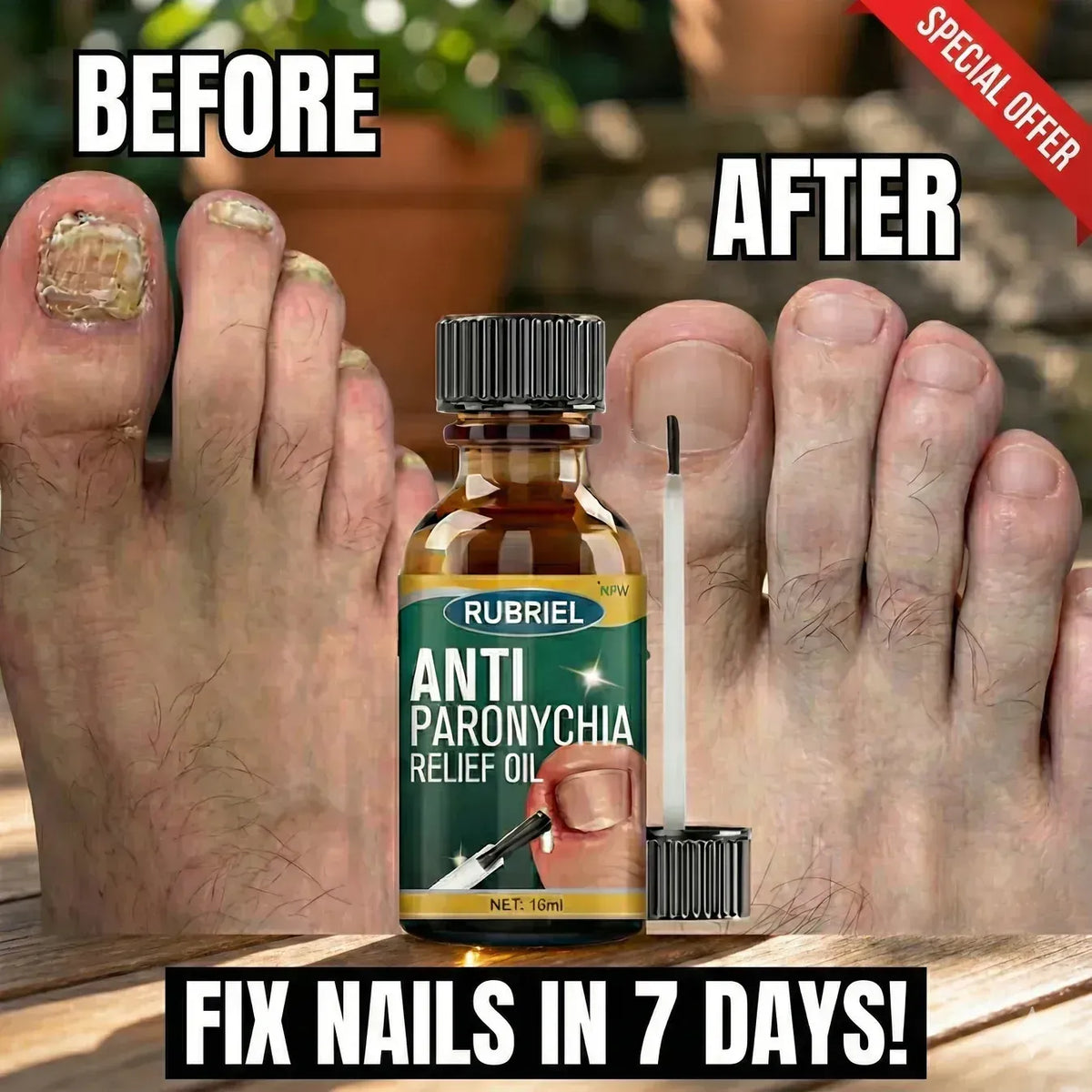 Anti Paronychia Relief Oil - Buy 1 Get 1 FREE🔥