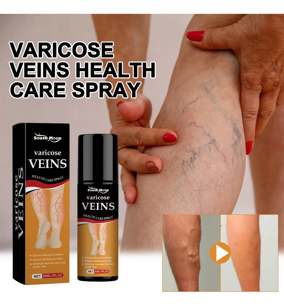Turmeric Varicose Relief Herbal Spray 🌿