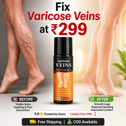 Turmeric Varicose Relief Herbal Spray 🌿