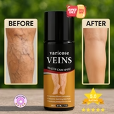 Turmeric Varicose Relief Herbal Spray 🌿